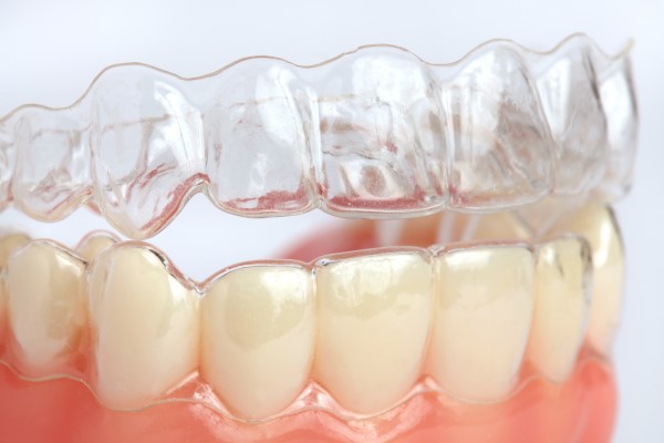 Teeth Straightening With Clear Aligners