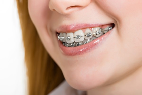 How To Select The Right Orthodontist Near Me